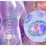 Уретрит: симптоми, причини, лікування та профілактика