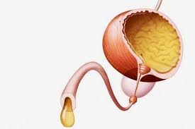 Уретрит: симптоми, причини, лікування та профілактика